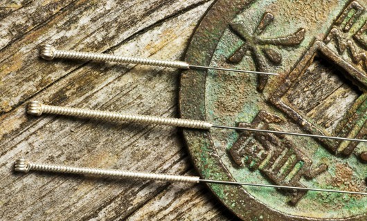 Acupuncture Sydney